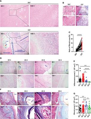 Echinococcus granulosus: The establishment of the metacestode in the liver is associated with control of the CD4+ T-cell-mediated immune response in patients with cystic echinococcosis and a mouse model